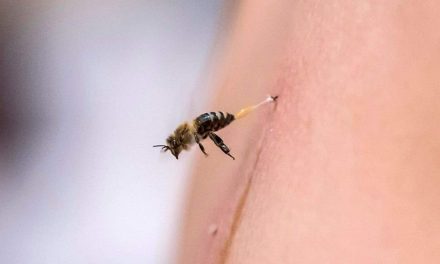 Treating The Honeybee Stings Effectively!